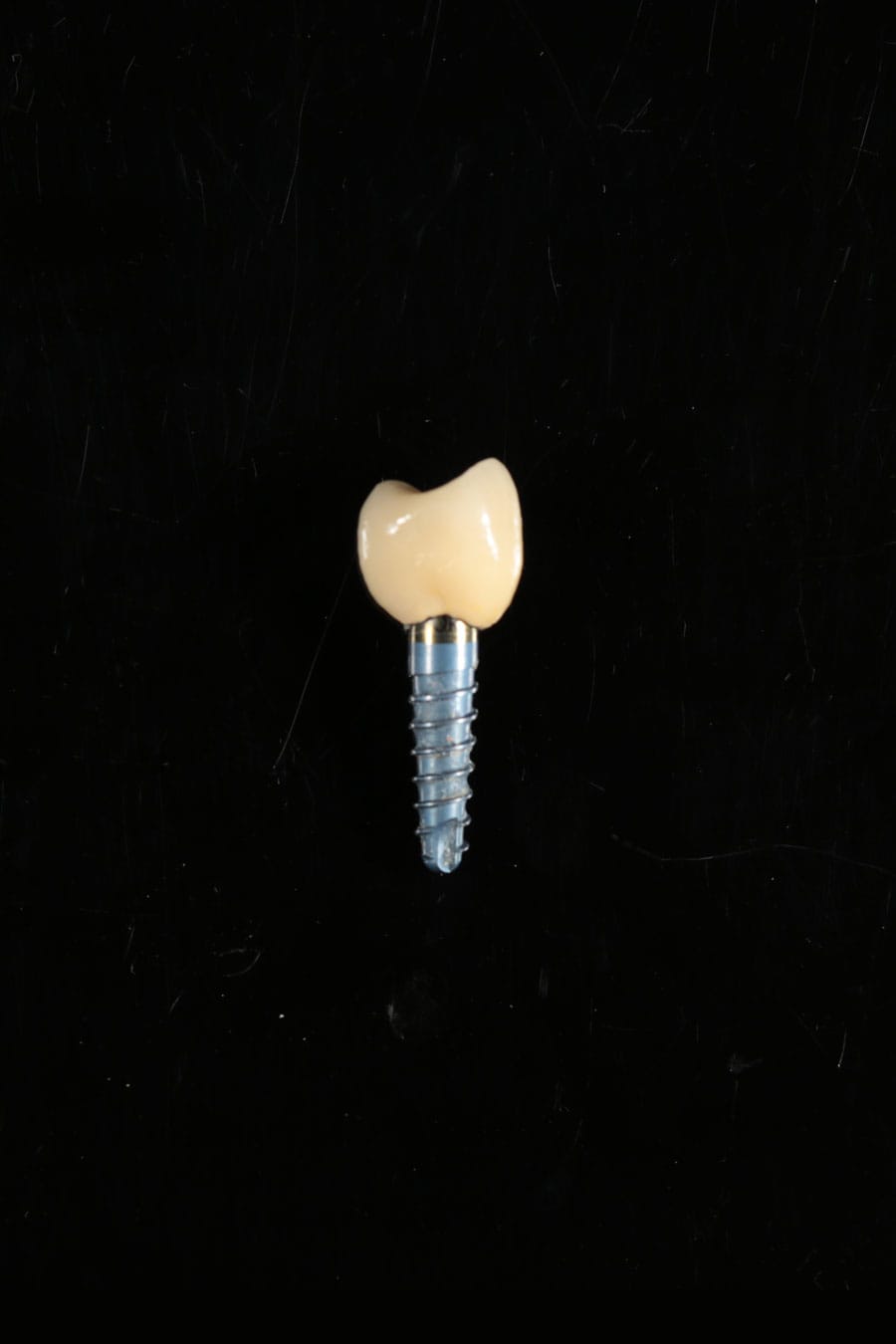 Implantati